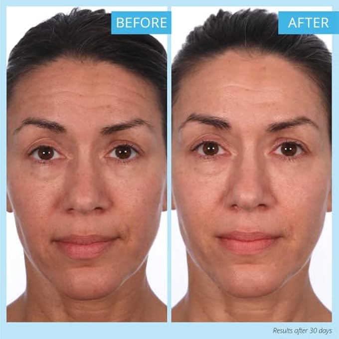 Skinn CRME REVERSE WITH FERULIC ACID, RETINOL AND VITAMIN C-CRME REVERSE INTENSIVE-ANTI-AGING CREAM WITH HYALURONIC ACID TO PLUMP SKIN VITAMIN C HELP TO IMPROVING TONE, FIRMNESS OF SKIN - Image 4